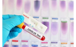 Mikor mutatják ki a fertőzést a koronavírus gyorstesztek?